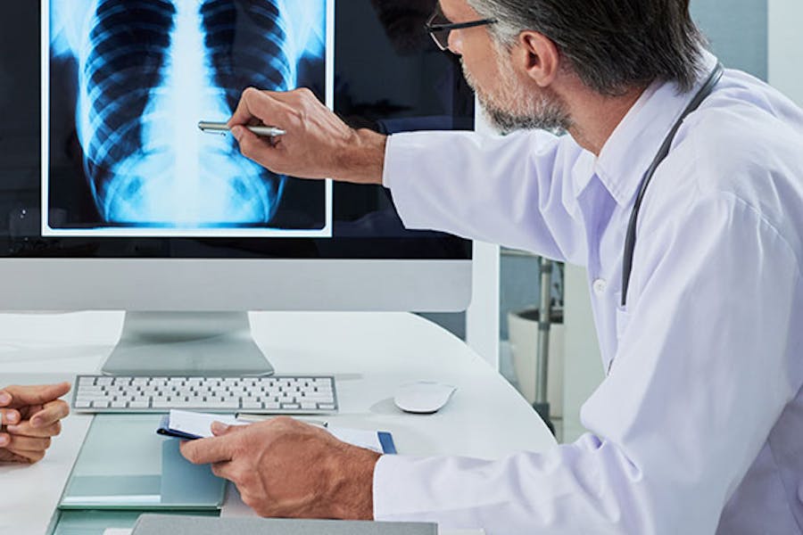 Doctor and patient look at lung x-ray