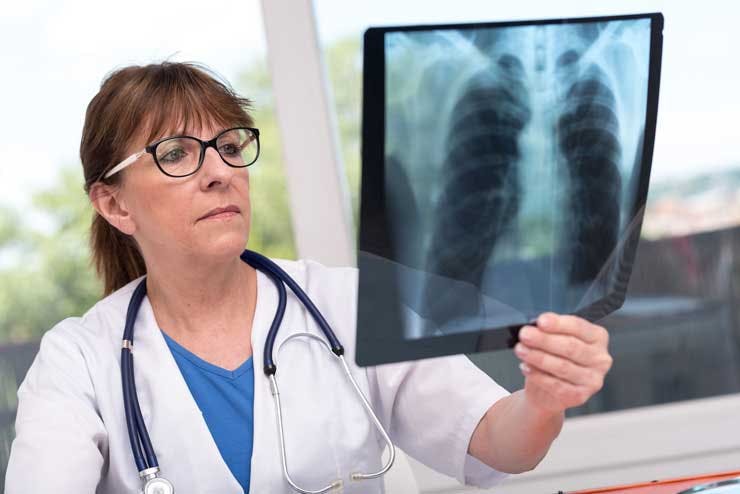 Doctor looking at chest X-ray