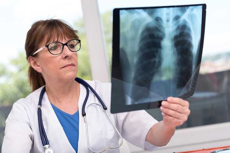 Ärztin begutachtet Röntgenbild der Lunge