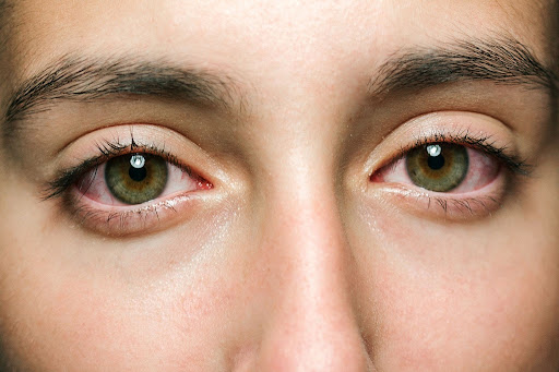 Marihuana y Ojos Rojos Todo lo que debes saber Cannigma ES